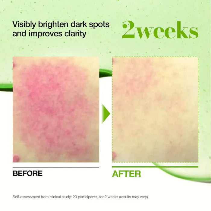 Anua Azelaic Acid 10 Hyaluron Redness Soothing Serum