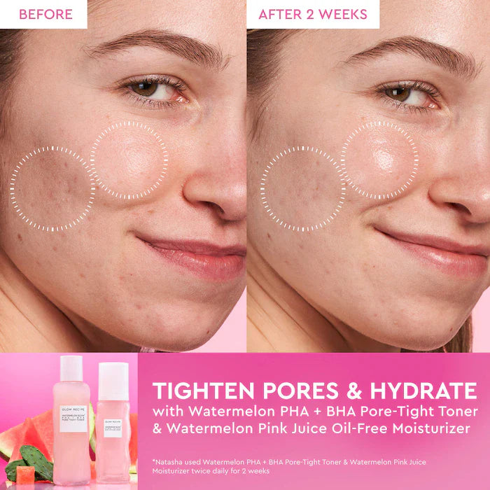 Glow Recipe  Watermelon Pink Juice Oil-Free Refillable Moisturizer